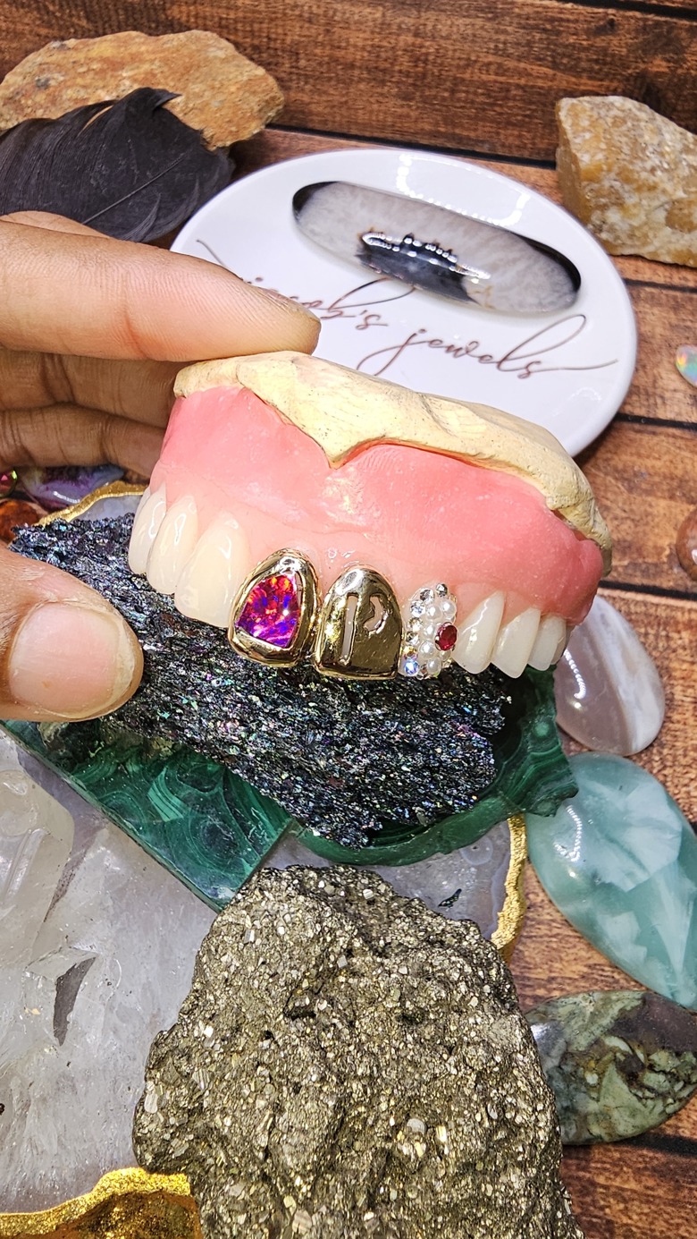 Dentures Tops Only Gold Teeth Diamonds Letter Dentures You Can