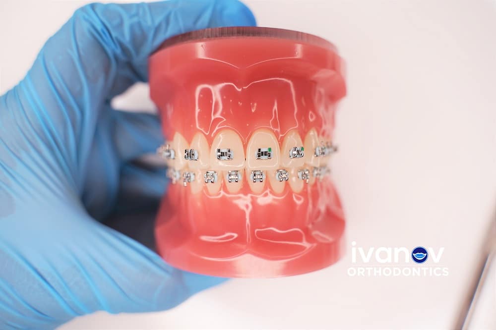Is Tooth Whitening Safe For Your Enamel?