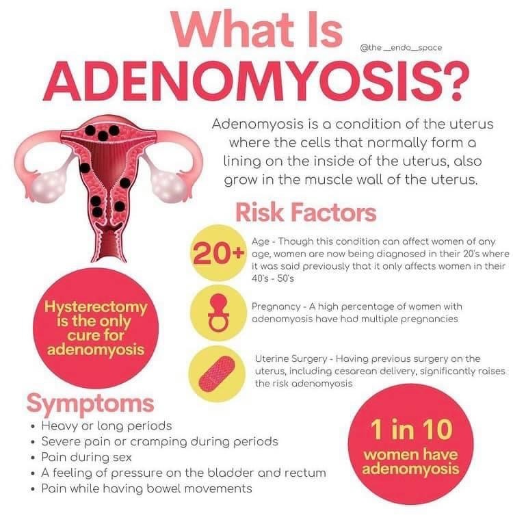 Adenomyosis - Ko-fi ️ Where creators get support from fans through ...