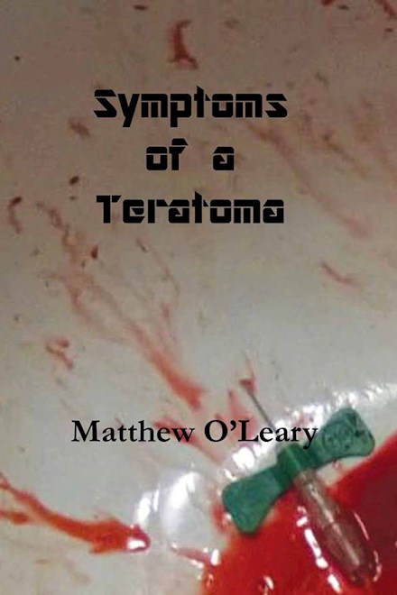 Symptoms of a Teratoma