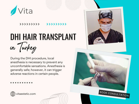 DHI Hair Transplant in Turkey