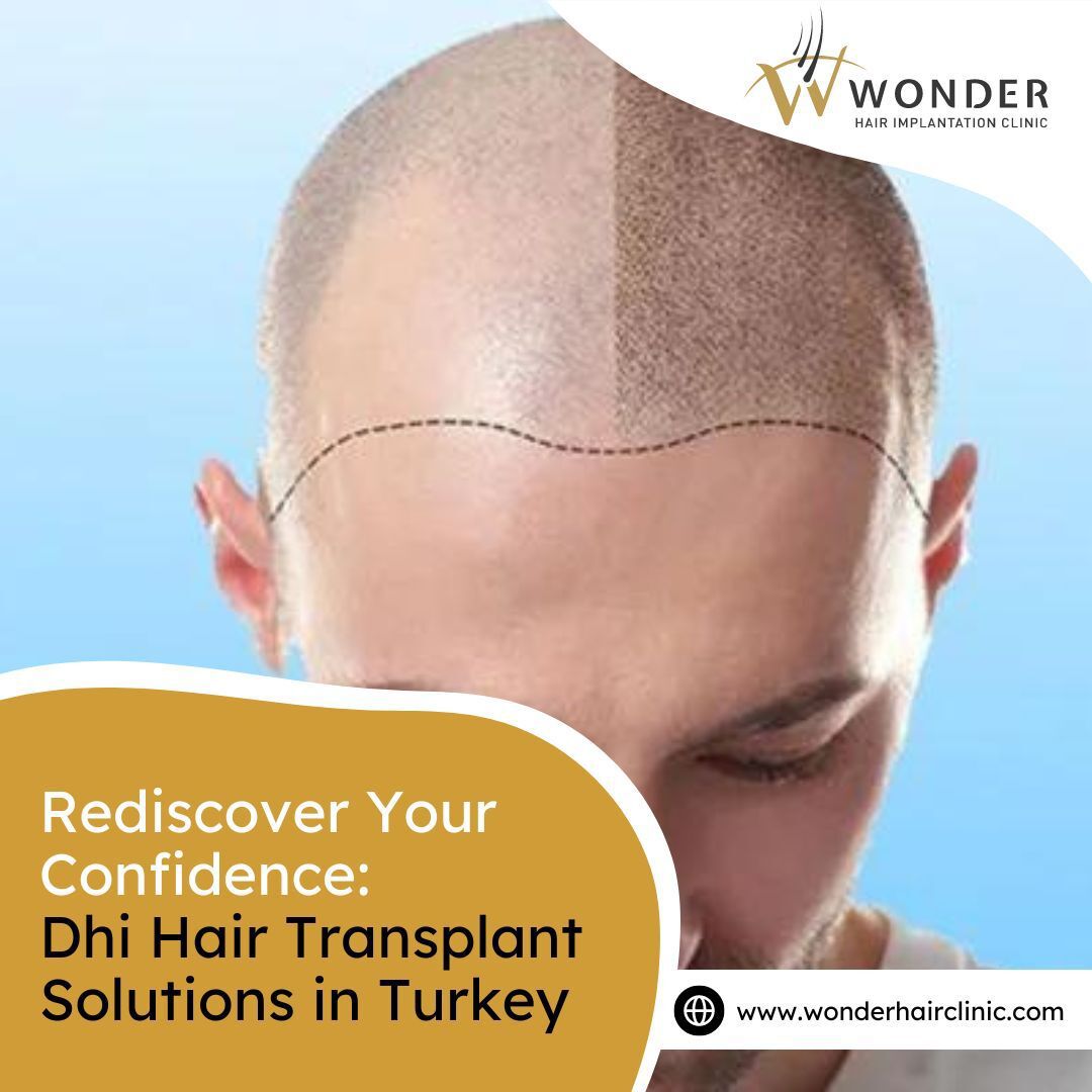 Dhi Hair Transplant in Turkey | Wonder Hair Clinic